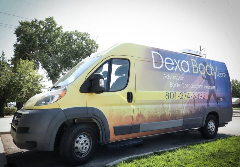 The Dexa Body mobile DEXA scanning van